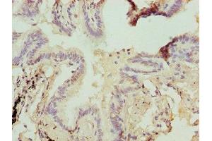 Immunohistochemistry of paraffin-embedded human lung tissue using ABIN7154897 at dilution of 1:100 (HSBP1 Antikörper  (AA 1-75))