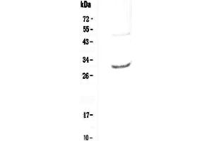 Western blot analysis of IL27 using anti-IL27 antibody . (IL-27 Antikörper  (AA 29-234))