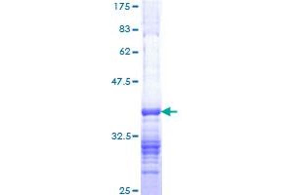 MTA2 Protein (AA 521-620) (GST tag)
