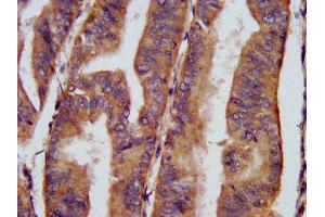 Immunohistochemistry (IHC) image for anti-Cholinergic Receptor, Nicotinic, beta 3 (Neuronal) (CHRNB3) (AA 67-218) antibody (ABIN7161356)