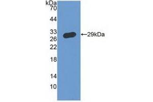 Detection of Recombinant IFNgR1, Human using Polyclonal Antibody to Interferon Gamma Receptor 1 (IFNgR1) (IFNGR1 Antikörper  (AA 18-245))