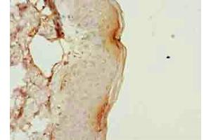 Immunohistochemistry (IHC) image for anti-Plasminogen Receptor, C-Terminal Lysine Transmembrane Protein (PLGRKT) (AA 1-147) antibody (ABIN7163544)