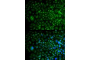 Immunofluorescence analysis of U20S cell using ANG antibody. (ANG Antikörper  (AA 25-147))