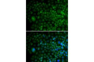 Immunofluorescence analysis of U20S cell using ANG antibody. (ANG Antikörper  (AA 25-147))
