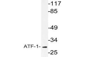 Western blot (WB) analysis of ATF-1 antibody in extracts from COLO cells. (AFT1 Antikörper)