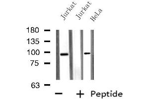 Western blot analysis of extracts from HeLa/Jurkat cells, using PTPN22 antibody. (PTPN22 Antikörper  (C-Term))