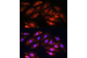 Immunofluorescence analysis of H9C2 cells using OTUB1 antibody (ABIN6128400, ABIN6145086, ABIN6145088 and ABIN6215346) at dilution of 1:100. (OTUB1 Antikörper  (AA 1-220))