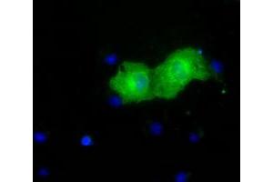 Anti-PKLR mouse monoclonal antibody (ABIN2453475) immunofluorescent staining of COS7 cells transiently transfected by pCMV6-ENTRY PKLR (RC206455). (PKLR Antikörper)