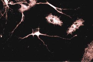 Immunofluorescent staining of Rat Neurons with anti-Adaptin gamma antibody. (gamma 1 Adaptin Antikörper  (AA 642-821))