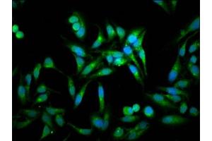 Immunofluorescence staining of Hela cells with ABIN7143230 at 1:100, counter-stained with DAPI. (ACOT1 Antikörper  (AA 258-350))
