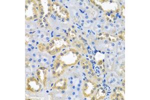 Immunohistochemistry of paraffin-embedded rat kidney using NDUFB10 antibody (ABIN5972156) at dilution of 1/100 (40x lens). (NDUFB10 Antikörper)