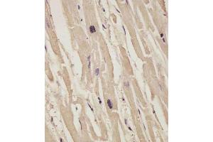 (ABIN6242834 and ABIN6578871) staining COL14A1 in human heart tissue sections by Immunohistochemistry (IHC-P - paraformaldehyde-fixed, paraffin-embedded sections). (COL14A1 Antikörper  (AA 643-677))