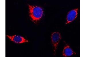 IF analysis of PITRM1 using anti-PITRM1 antibody (ABIN7601336).