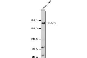 Western blot analysis of extracts of mouse liver, using COL2 antibody (560) at 1:1000 dilution.
