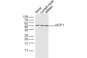 Mouse bone, lymph node, and spleen lysates probed with Polyclonal Antibody, unconjugated  at 1:300 overnight at 4°C followed by a conjugated secondary antibody at 1:10000 for 90 minutes at 37°C. (NCF1 Antikörper  (AA 151-250))