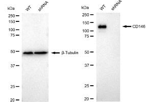 Western blotting analysis using CD146 antibody (ABIN7799362). (Rekombinanter MCAM Antikörper)