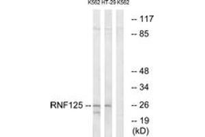 Western blot analysis of extracts from K562/HT-29 cells, using RNF125 Antibody. (RNF125 Antikörper  (AA 131-180))
