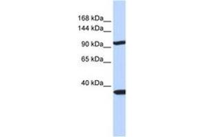 Image no. 1 for anti-Pappalysin 2 (PAPPA2) (AA 108-157) antibody (ABIN6743109) (PAPPA2 Antikörper  (AA 108-157))