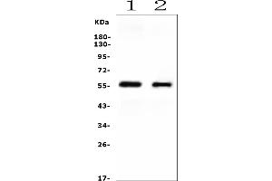 Western blot analysis of CYP2E1 using anti-CYP2E1 antibody (ABIN7601446).