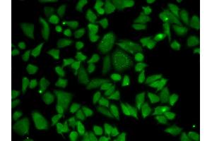 Immunofluorescence analysis of A549 cells using ALDH2 antibody. (ALDH2 Antikörper)