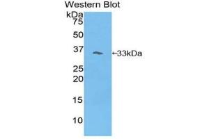 Western blot analysis of the recombinant protein. (PIK3AP1 Antikörper  (AA 397-650))
