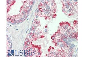 ABIN5539537 (5µg/ml) staining of paraffin embedded Human Prostate. (HRH3 Antikörper  (Internal Region))