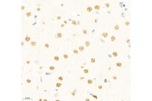 Immunohistochemistry of paraffin embedded rat brain using LDOCL (ABIN7075411) at dilution of 1:1400 (400x lens) (Retrotransposon Gag-Like Protein 6 (RTL6) Antikörper)