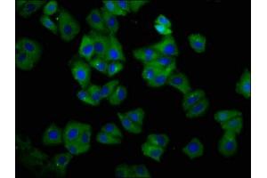 Immunofluorescence staining of HepG2 cells with ABIN7155567 at 1:66, counter-stained with DAPI. (HLA-C Antikörper  (AA 200-306))
