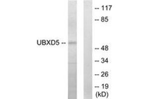 Western Blotting (WB) image for anti-UBX Domain Protein 11 (UBXN11) (AA 131-180) antibody (ABIN2889637) (UBXN11 Antikörper  (AA 131-180))
