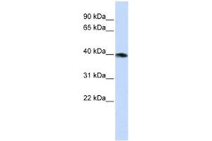 GNAZ antibody used at 1 ug/ml to detect target protein. (GNaZ Antikörper)