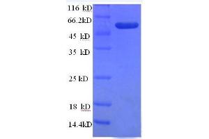 SDS-PAGE (SDS) image for Tumor Necrosis Factor (Ligand) Superfamily, Member 10 (TNFSF10) (AA 39-281) protein (GST tag) (ABIN1047805)