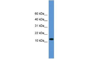 WB Suggested Anti-TAC1 Antibody Titration: 1.
