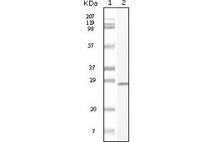 Western Blotting (WB) image for anti-Mast/stem Cell Growth Factor Receptor (KIT) (truncated) antibody (ABIN2464038) (KIT Antikörper  (truncated))