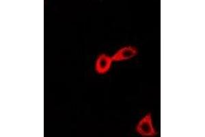 Immunofluorescent analysis of CARS staining in Hela cells. (CARS Antikörper)