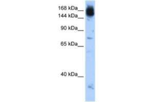Western Blotting (WB) image for anti-Non-SMC Condensin I Complex, Subunit D2 (NCAPD2) antibody (ABIN2462956) (NCAPD2 Antikörper)
