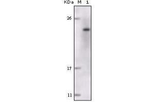 Western Blot showing FES antibody used against truncated FES recombinant protein. (FES Antikörper)