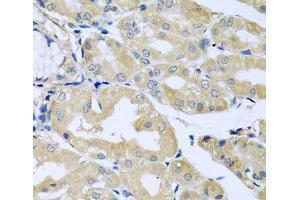Immunohistochemistry of paraffin-embedded Human stomach using HS1BP3 Polyclonal Antibody at dilution of 1:100 (40x lens). (HS1BP3 Antikörper)