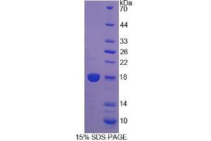 Image no. 1 for Dual Specificity Phosphatase 5 (DUSP5) (AA 1-135) protein (His tag) (ABIN6237141)