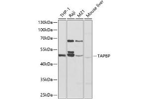 Western blot analysis of extracts of various cell lines, using TAPBP antibody (ABIN6132744, ABIN6148847, ABIN6148849 and ABIN6217320) at 1:1000 dilution. (TAPBP Antikörper  (AA 30-260))