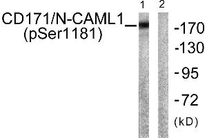 Western blot analysis of extracts from K562 cells, using CD171/N-CAML1 (Phospho-Ser1181) antibody. (L1CAM Antikörper  (pSer1181))