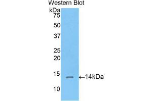 Western blot analysis of the recombinant protein. (Corin Antikörper  (AA 533-634))