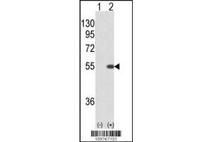 Western blot analysis of STK40 using rabbit polyclonal STK40 using 293 cell lysates (2 ug/lane) either nontransfected (Lane 1) or transiently transfected with the STK40 gene (Lane 2). (STK40 Antikörper  (C-Term))