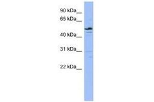 Image no. 1 for anti-Zinc Finger Protein 419 (ZNF419) (AA 107-156) antibody (ABIN6742639) (ZNF419 Antikörper  (AA 107-156))