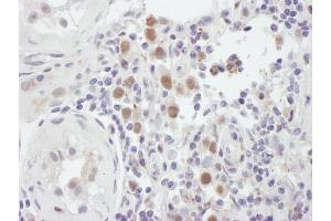Immunohistochemistry (IHC) image for anti-MutS Homolog 6 (E. Coli) (MSH6) (C-Term) antibody (ABIN7454511) (MSH6 Antikörper  (C-Term))