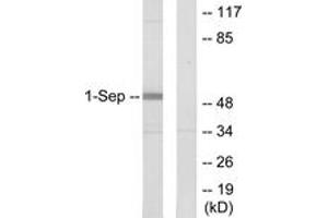 Western Blotting (WB) image for anti-Septin 1 (SEPT1) (AA 181-230) antibody (ABIN2889699) (Septin 1 Antikörper  (AA 181-230))