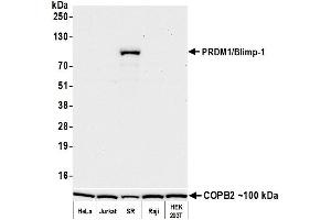 Western Blotting (WB) image for anti-PR Domain Containing 1, with ZNF Domain (PRDM1) (AA 375-425) antibody (ABIN7795637)