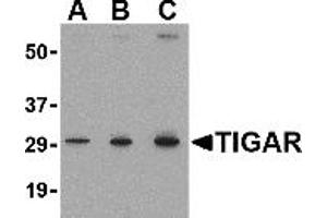 Western Blotting (WB) image for anti-TP53 induced glycolysis regulatory phosphatase (TIGAR) (Middle Region 2) antibody (ABIN1031205)