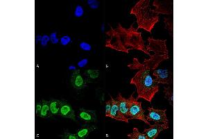 Immunocytochemistry/Immunofluorescence analysis using Mouse Anti-Alpha Synuclein Monoclonal Antibody, Clone 10H7 (ABIN5564072).