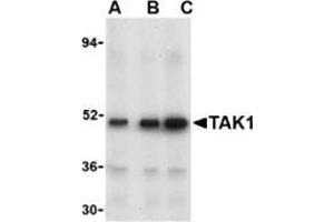 Western blot analysis of TAK1 in Rat thymus cell lysate with this product at (A) 1, (B) 2, and (C) 4 μg/ml. (MAP3K7 Antikörper  (N-Term))