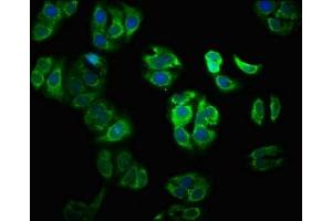 Immunofluorescence staining of HepG2 cells with ABIN7175958 at 1:100, counter-stained with DAPI.